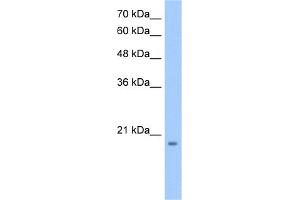 WB Suggested Anti-MGC4172 Antibody Titration:  0. (MGC4172 (C-Term) antibody)