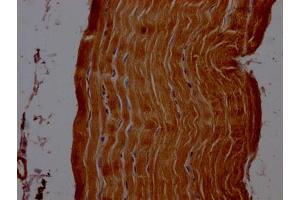 IHC image of ABIN7143815 diluted at 1:200 and staining in paraffin-embedded human skeletal muscle tissue performed on a Leica BondTM system. (ACTN2 antibody  (AA 1-301))