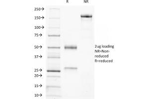 SDS-PAGE Analysis Purified Ku Mouse Monoclonal Antibody (KU729).
