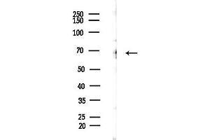 anti-Forkhead Box J3 (FOXJ3) (C-Term) antibody