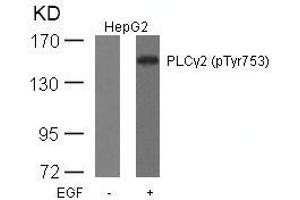 Western blot analysis of extracts from HepG2 cells untreated or treated with EGF using PLCg2(Phospho-Tyr753) Antibody. (Phospholipase C gamma 2 antibody  (pTyr753))
