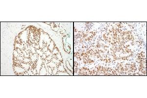 Immunohistochemistry (IHC) image for anti-Splicing Factor 3b, Subunit 3, 130kDa (SF3B3) (AA 1167-1217) antibody (ABIN7454831)