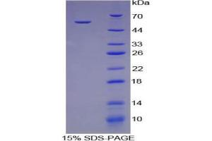 SDS-PAGE analysis of Pig Cathepsin K Protein. (Cathepsin K Protein (CTSK))