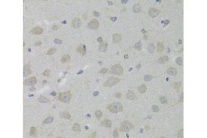 Immunohistochemistry of paraffin-embedded Rat brain using HSD17B13 Polyclonal Antibody at dilution of 1:100 (40x lens).