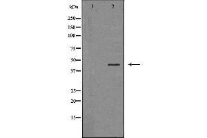 Western blot analysis of HepG2 cell lysate, using SERPINB3 Antibody.