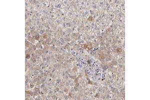 Immunohistochemical staining of human liver with FGB polyclonal antibody  shows moderate cytoplasmic positivity in hepatocytes.