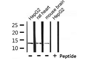 Western blot analysis of extracts from HepG2, rat heart and mouse brain, using NDUFA4L2 Antibody. (NDUFA4L2 antibody  (C-Term))