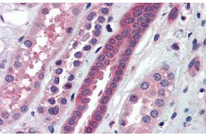 Immunohistochemistry with Human kidney lysate tissue at an antibody concentration of 5.
