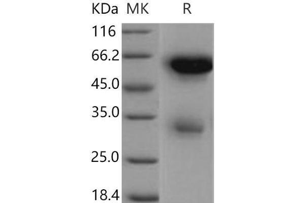 LGMN Protein (His tag)