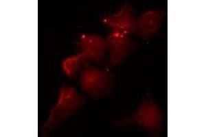 ABIN6275230 staining COLO205 by IF/ICC. (MGST2 antibody  (Internal Region))