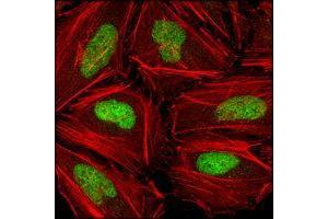 Confocal immunofluorescence analysis of Hela cells using CHK2 mouse mAb (green), showing nuclear localization.