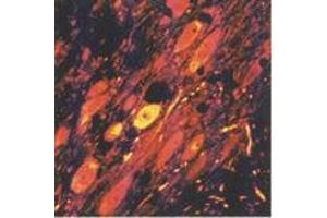 GABAergic neurons in the reticular nucleus of the thalamus (MAb 5A9, GABA) (GABA antibody)