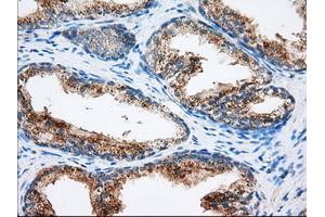 Immunohistochemistry (IHC) image for anti-Mitochondrial Translational Release Factor 1-Like (MTRF1L) antibody (ABIN1498695) (MTRF1L antibody)