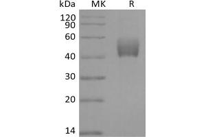 Western Blotting (WB) image for Transforming Growth Factor, beta Receptor 1 (TGFBR1) protein (Fc Tag) (ABIN7320892) (TGFBR1 Protein (Fc Tag))