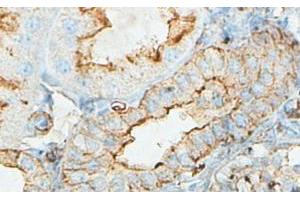 IHC analysis of formalin-fixed paraffin-embedded fetal kidney with cytoplasmic staining, using ACTBL2 antibody (1/100 dilution). (ACTBL2 antibody  (Middle Region))