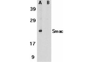 Image no. 2 for anti-Second Mitochondria-Derived Activator of Caspase (DIABLO) (AA 225-239) antibody (ABIN204877) (DIABLO antibody  (AA 225-239))