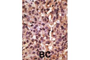 Immunohistochemistry (IHC) image for anti-BCL2/adenovirus E1B 19kDa Interacting Protein 3 (BNIP3) (BH3 Domain) antibody (ABIN2997216) (BNIP3 antibody  (BH3 Domain))