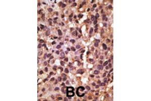 Immunohistochemistry (IHC) image for anti-BCL2/adenovirus E1B 19kDa Interacting Protein 3 (BNIP3) (BH3 Domain) antibody (ABIN2997216) (BNIP3 antibody  (BH3 Domain))