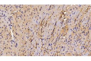 Detection of CAT in Mouse Cerebrum Tissue using Polyclonal Antibody to Catalase (CAT) (Catalase antibody  (AA 401-523))