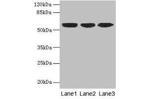 Western blot All lanes: KRT10 antibody at 6 μg/mL Lane 1: A431 whole cell lysate Lane 2: HepG2 whole cell lysate Lane 3: MCF-7 whole cell lysate Secondary Goat polyclonal to rabbit IgG at 1/10000 dilution Predicted band size: 59 kDa Observed band size: 59 kDa (Keratin 10 antibody  (AA 1-584))