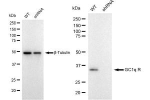 Western blotting analysis using GC1q R antibody (ABIN7798137). (Recombinant C1QBP antibody)