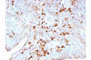 anti-lambda antibody