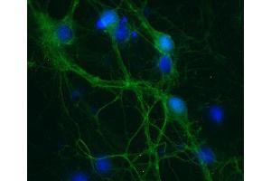 Indirect immunostaining of PFA fixed rat hippocampus neurons (dilution 1 : 500; green). (SNAP25 antibody  (AA 192-206))