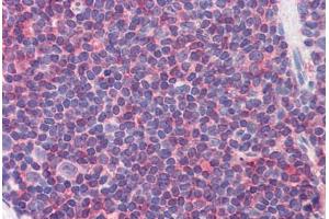 Human Colon, MALT (formalin-fixed, paraffin-embedded) stained with IL7R antibody ABIN351553 at 5 ug/ml followed by biotinylated goat anti-rabbit IgG secondary antibody ABIN481713, alkaline phosphatase-streptavidin and chromogen. (IL7R antibody  (pTyr449))