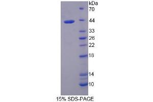 SDS-PAGE analysis of Mouse TIF1b Protein.