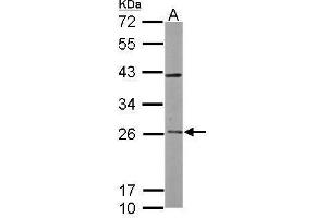 WB Image Sample (50 ug of whole cell lysate) A: mouse brain 12% SDS PAGE antibody diluted at 1:5000 (Rab3c antibody)