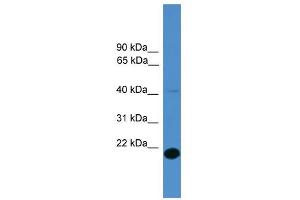 WB Suggested Anti-TMEM166 Antibody Titration: 0. (TMEM166 antibody  (Middle Region))