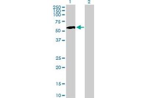 Western Blot analysis of IP6K1 expression in transfected 293T cell line by IP6K1 MaxPab polyclonal antibody. (IP6K1 antibody  (AA 1-441))