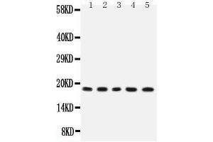Observed bind size: 18KD (IL-2 antibody  (AA 21-155))