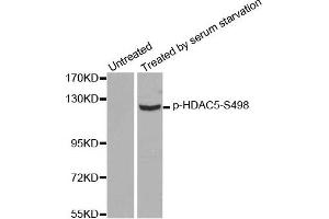 Western Blotting (WB) image for anti-Histone Deacetylase 5 (HDAC5) (pSer498) antibody (ABIN1870225) (HDAC5 antibody  (pSer498))