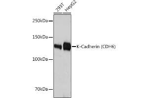 Western blot analysis of extracts of various cell lines, using K-Cadherin (CDH6) Rabbit mAb (ABIN1680831, ABIN3019147, ABIN3019148 and ABIN7101722) at 1:3000 dilution. (CDH6 antibody)