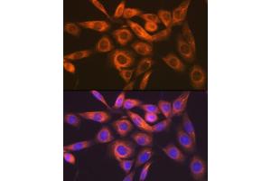 Immunofluorescence analysis of NIH-3T3 cells using IMPDH2 Rabbit mAb  at dilution of 1:100 (40x lens). (IMPDH2 antibody)