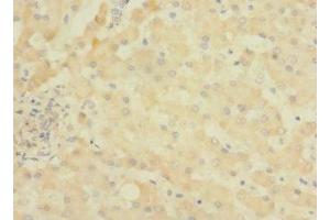 Immunohistochemistry of paraffin-embedded human liver tissue using ABIN7144737 at dilution of 1:100 (ASPHD1 antibody  (AA 96-390))