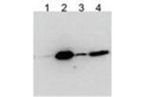 HEK293 overexpressing Human BICC1 with N-terminal FLAG, probed with Rabbit anti-BCC1 in Western Blot after IP using either AP31787PU-N or anti-FLAG antibody in the presence or absence of SDS. (BICC1 antibody  (Internal Region))