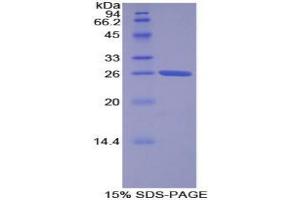 SDS-PAGE analysis of Human Torsin 2A Protein. (TOR2A Protein)