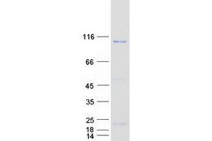 Western Blotting (WB) image for Pitrilysin Metallopeptidase 1 (PITRM1) protein (Myc-DYKDDDDK Tag) (ABIN2729026)