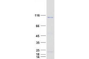 Validation with Western Blot (PITRM1 Protein (Myc-DYKDDDDK Tag))