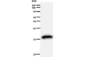 Western Blotting (WB) image for anti-Upstream Transcription Factor 2, C-Fos Interacting (USF2) antibody (ABIN930972) (USF2 antibody)