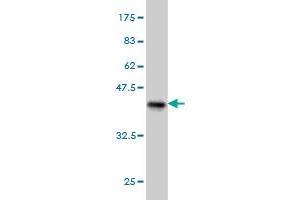 Western Blot detection against Immunogen (37. (PDHB antibody  (AA 250-359))