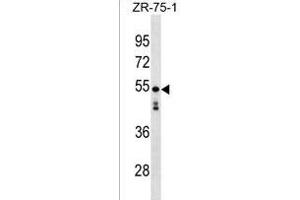 KT81L Antibody (N-term) (ABIN1539665 and ABIN2838076) western blot analysis in ZR-75-1 cell line lysates (35 μg/lane). (KT81L (AA 96-122), (N-Term) antibody)