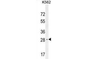 Western Blotting (WB) image for anti-Olfactory Receptor, Family 52, Subfamily D, Member 1 (OR52D1) antibody (ABIN2995907)