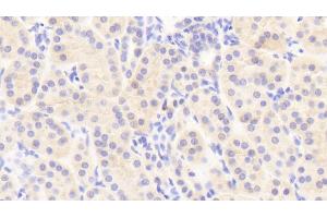 Detection of TJP1 in Human Kidney Tissue using Polyclonal Antibody to Tight Junction Protein 1 (TJP1) (TJP1 antibody  (AA 1-190))