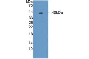 Detection of Recombinant PLA2R1, Mouse using Polyclonal Antibody to Phospholipase A2 Receptor 1 (PLA2R1) (PLA2R1 antibody  (AA 1418-1487))
