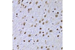 Immunohistochemistry of paraffin-embedded mouse brain using SOX5 antibody. (SOX5 antibody  (AA 1-120))