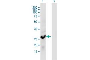 Western Blot analysis of RGS18 expression in transfected 293T cell line by RGS18 monoclonal antibody (M01A), clone 1H6. (RGS18 antibody  (AA 1-235))