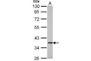 WB Image Cathepsin S antibody detects CTSS protein by Western blot analysis. (Cathepsin S antibody)